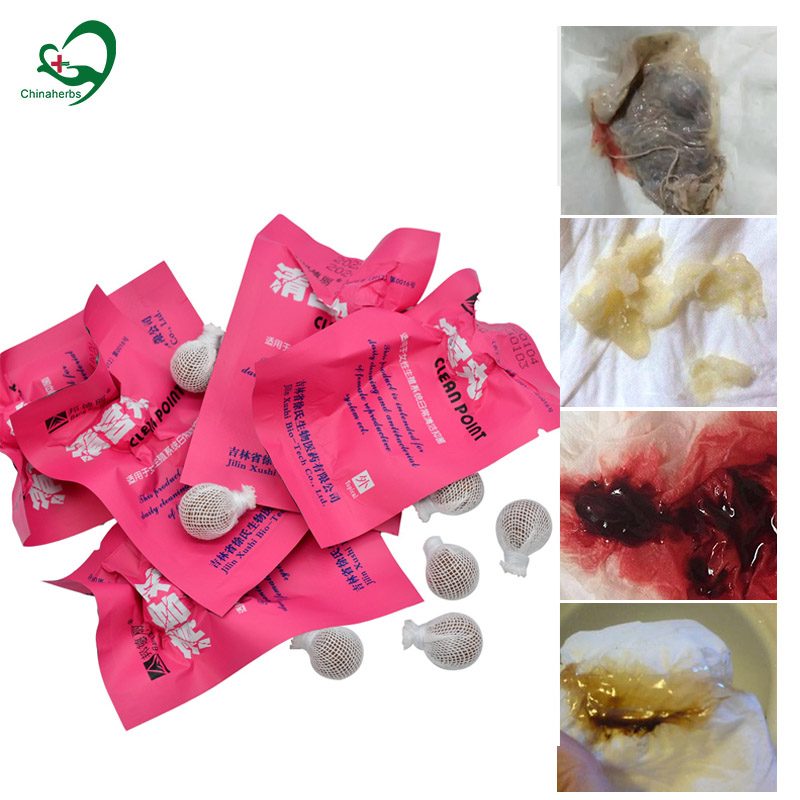 20pcs Yoni Pearls Clean Point  - Medical Wellness & Spa Werona บทวิจารณ์และราคา